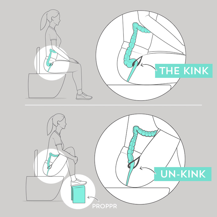 Kink vs unkinked toilet position